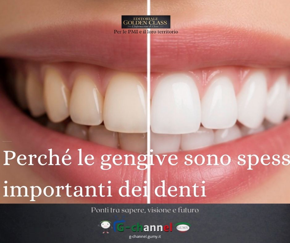 Perché le gengive sono spesso più importanti dei denti