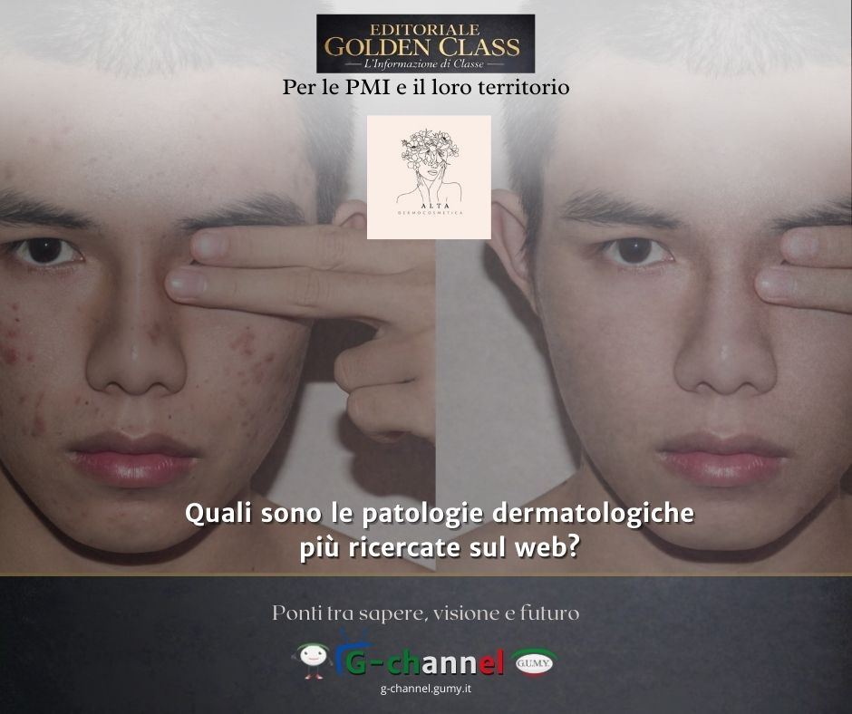Quali sono le patologie dermatologiche più ricercate sul web?