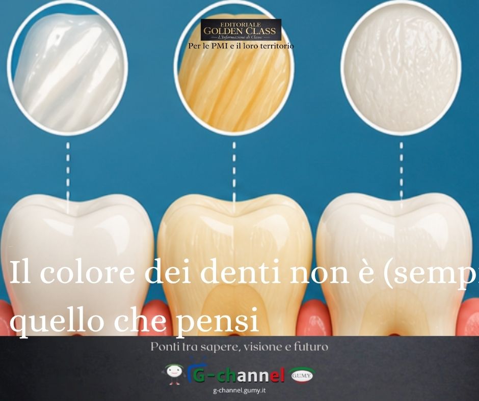 Il colore dei denti non è (sempre) quello che pensi