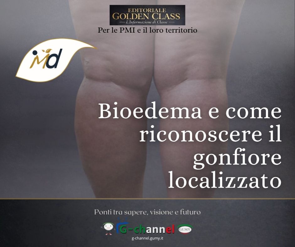 Bioedema e come riconoscere il gonfiore localizzato