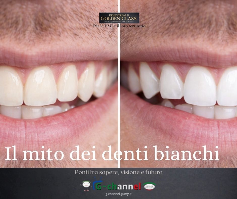 Il mito dei denti bianchi