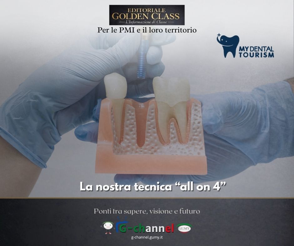 La nostra tecnica “all on 4”