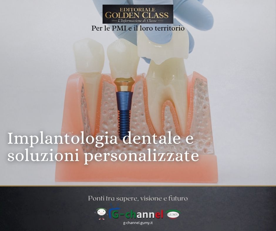 Implantologia dentale e soluzioni personalizzate