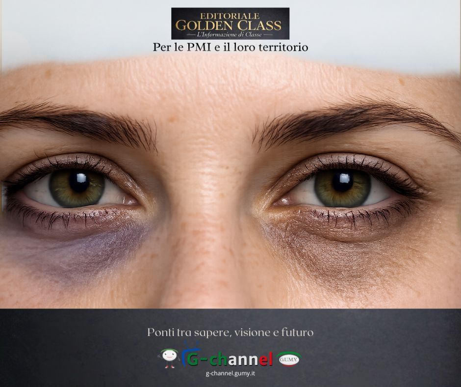 Occhiaie: cosa rivelano su salute e stile di vita