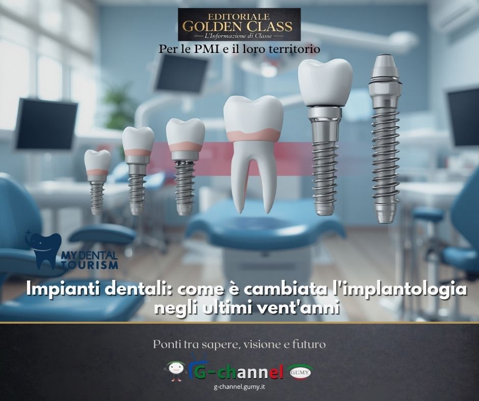 Impianti dentali: come è cambiata l'implantologia negli ultimi vent'anni
