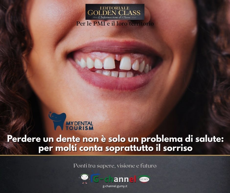 Perdere un dente non è solo un problema di salute: per molti conta soprattutto il sorriso